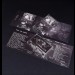 FOREST - Forest Tape